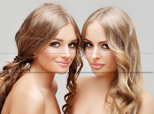 Effective pigmentation treatments: Discover the best solutions for skin discoloration