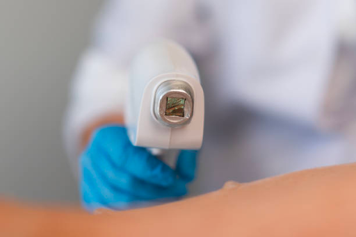 IPL Hair Removal Side Effects: What to Expect